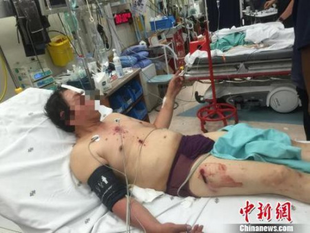 來自廣西柳州的受傷男子,。鐘欣 攝 來自廣西柳州的受傷男子,。鐘欣 攝