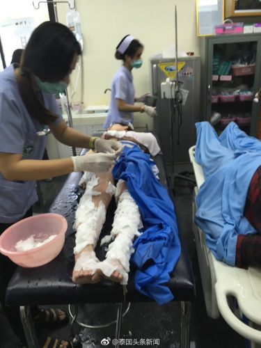 泰國皮皮島附近一快艇突發(fā)爆炸,,多名中國人受傷(圖:泰國頭條新聞微博) 泰國皮皮島附近一快艇突發(fā)爆炸,,多名中國人受傷(圖:泰國頭條新聞微博)