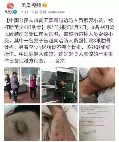 中國公民被越南邊檢人員索要小費不成被毆打致骨折 新聞來源：鳳凰視頻