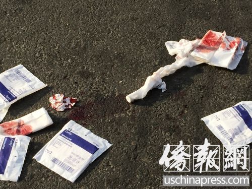 東百老匯139號好炒手中式快餐館門外發(fā)生吃“霸王餐”并打傷店主事件,地上遺下血跡,。(美國《僑報》/葉永康
