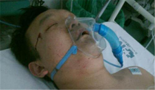 中國僑網(wǎng)圖為被毆打成重傷的華人男子,,目前仍在醫(yī)院中接受治療,。(西班牙歐浪網(wǎng)圖片)