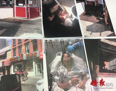 中國僑網(wǎng)陳秀貞手術(shù)圖片以及事發(fā)現(xiàn)場圖片,。(美國《僑報》/傷者提供 張晶翻拍)