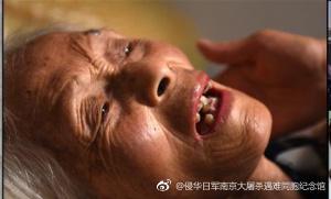 中國僑網(wǎng)病臥在床的顧秀蘭。圖片來源:侵華日軍南京大屠殺遇難同胞紀(jì)念館官方微博 ,。