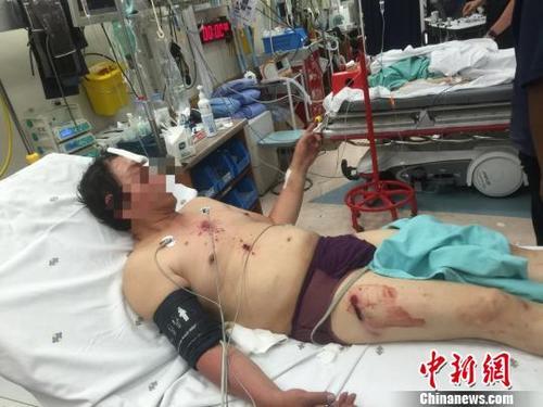 中國僑網(wǎng)受傷男子。 鐘欣 攝